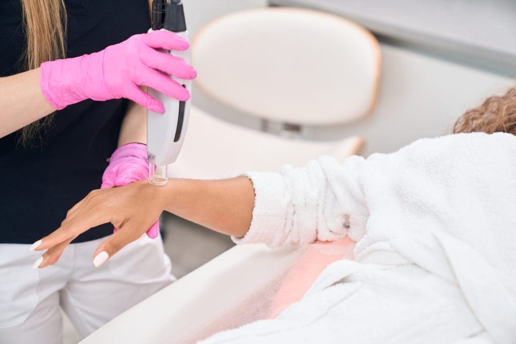 Laser Hair Removal San Diego treatment for hands
