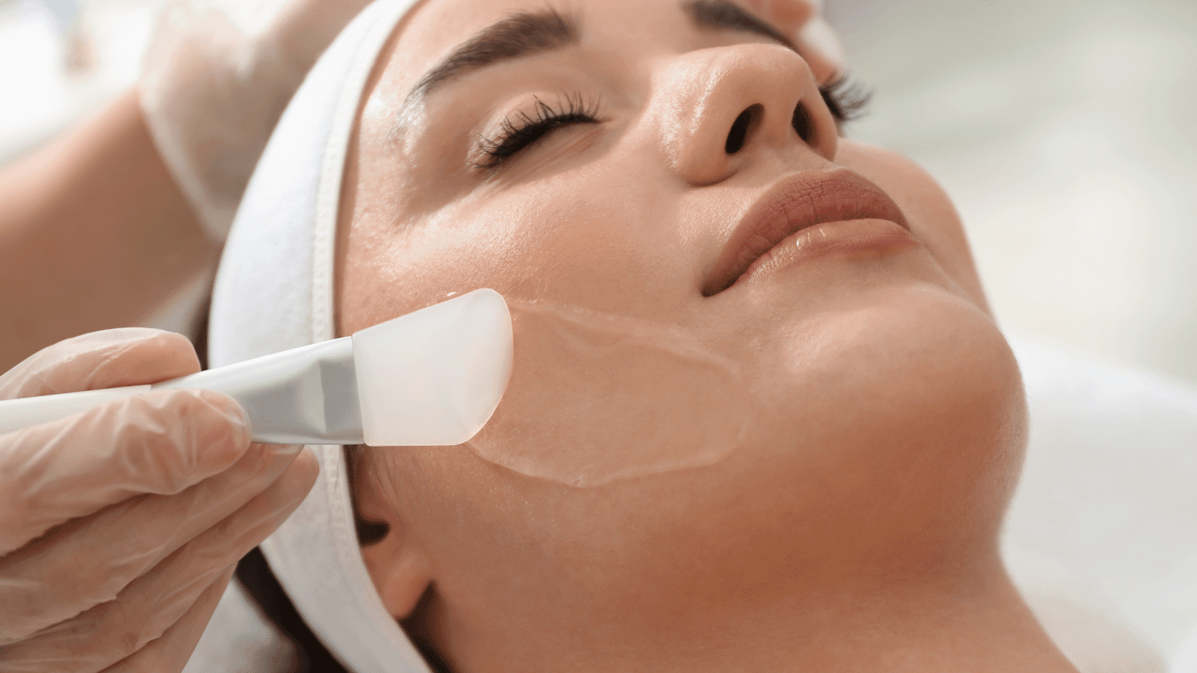 Chemical Peels: A Complete Guide to Transforming Your Skin
