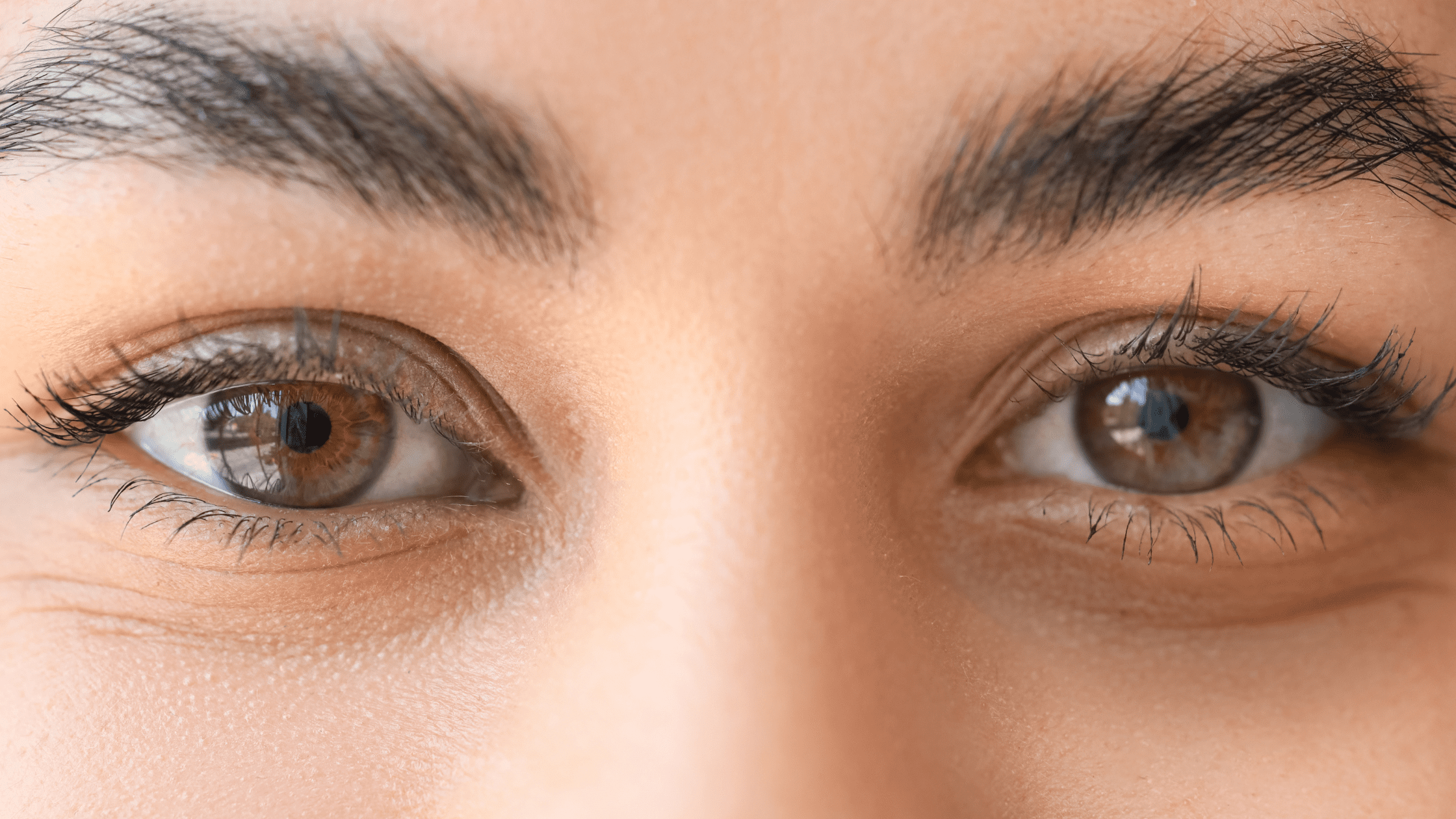 How To Remove Dark Circles Under Eyes