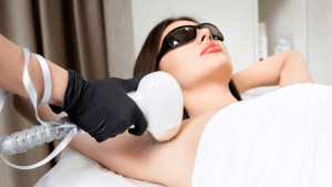 a woman getting laser hair removal