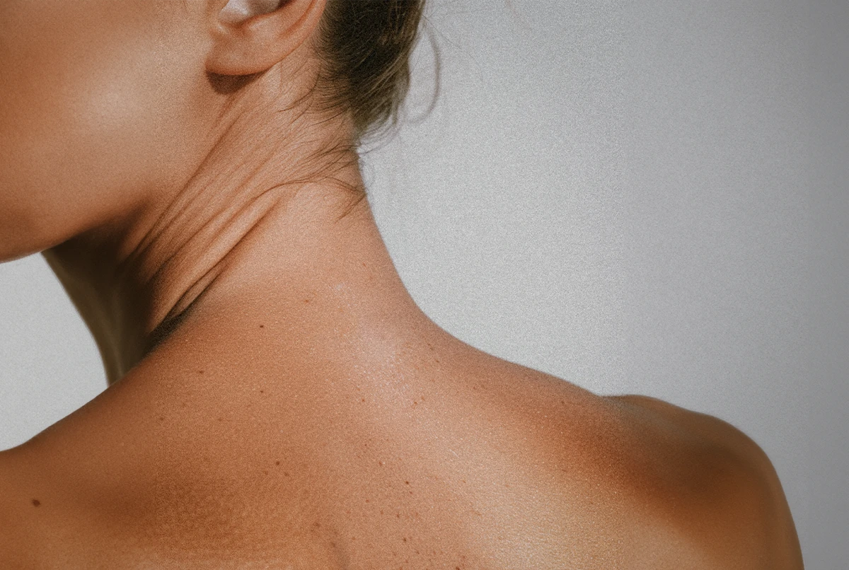 Close-up of a person's neck and shoulder, showing skin texture and tone