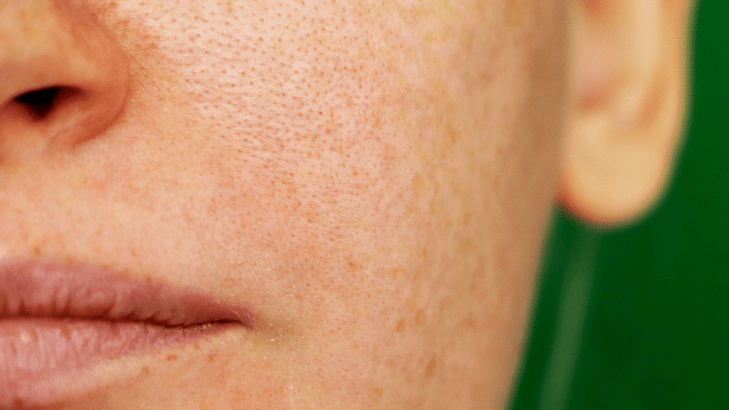 Close-up of a person's lower face showing skin texture and lips
