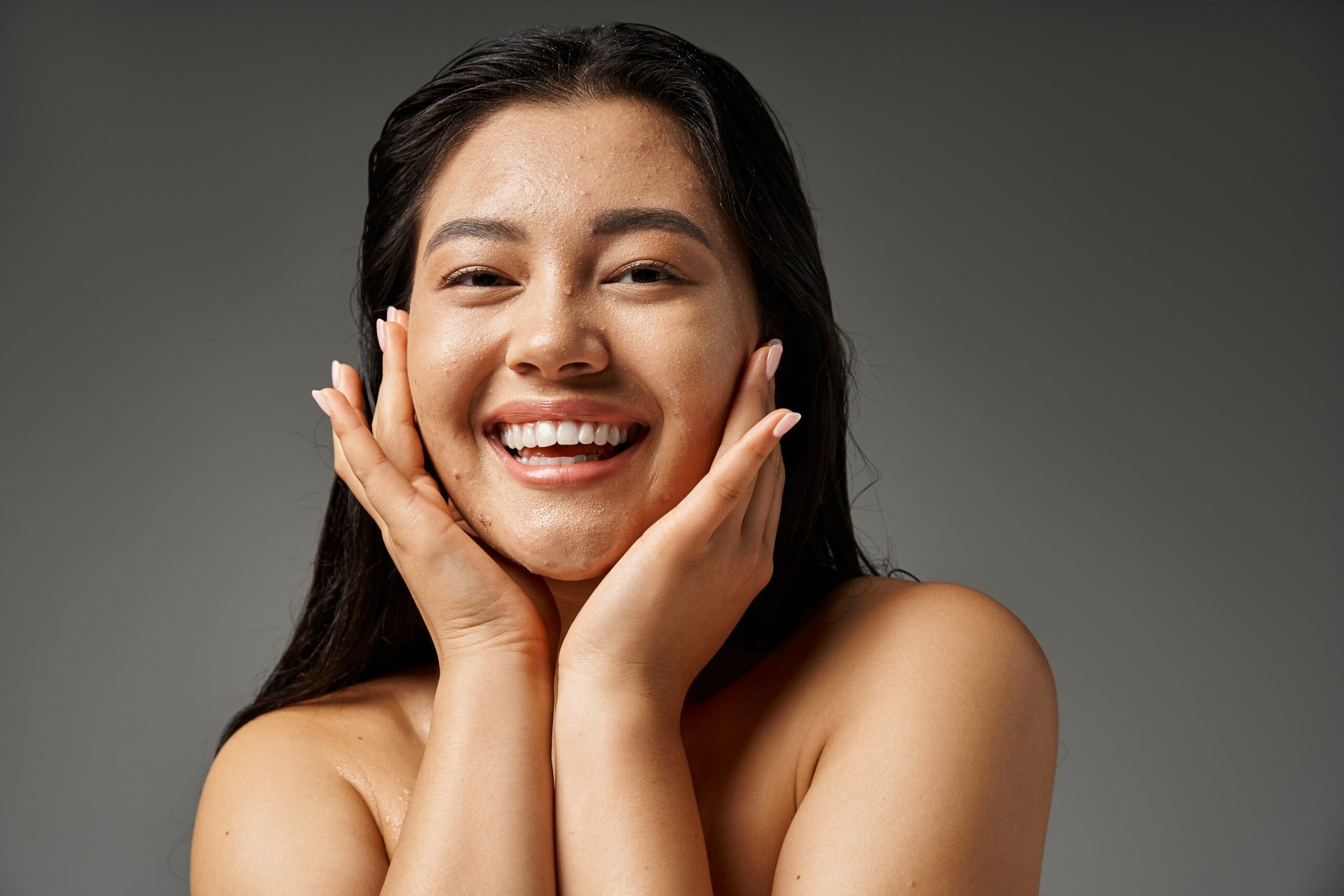 Acne Treatment in Santee, CA