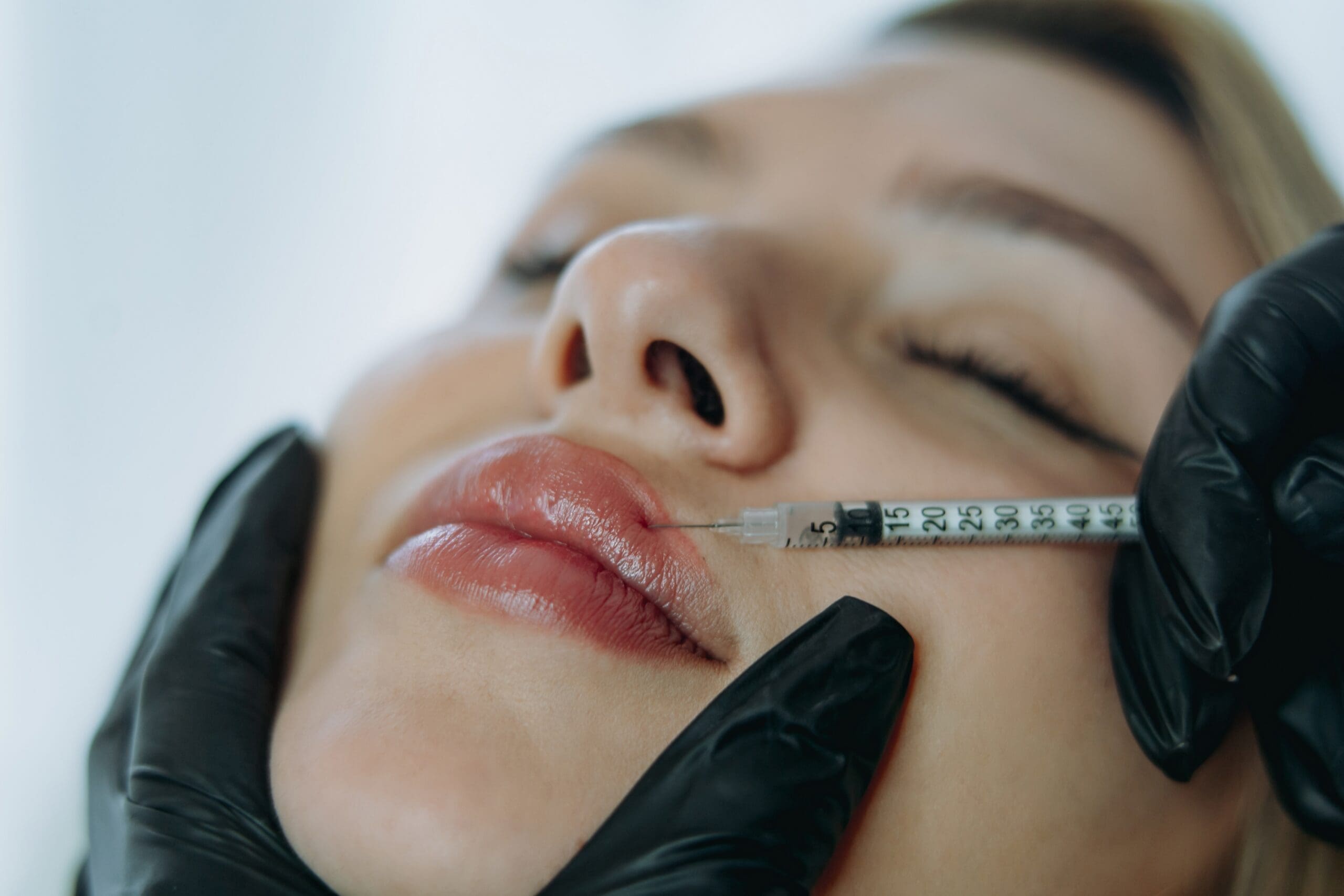 Juvederm vs Restylane: Which Is Right for You?